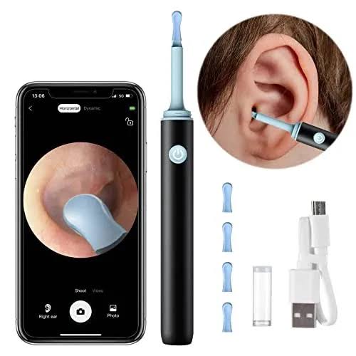 Smart Visual Ear Cleaner with HD Camera – Wireless Ear Wax Removal Tool