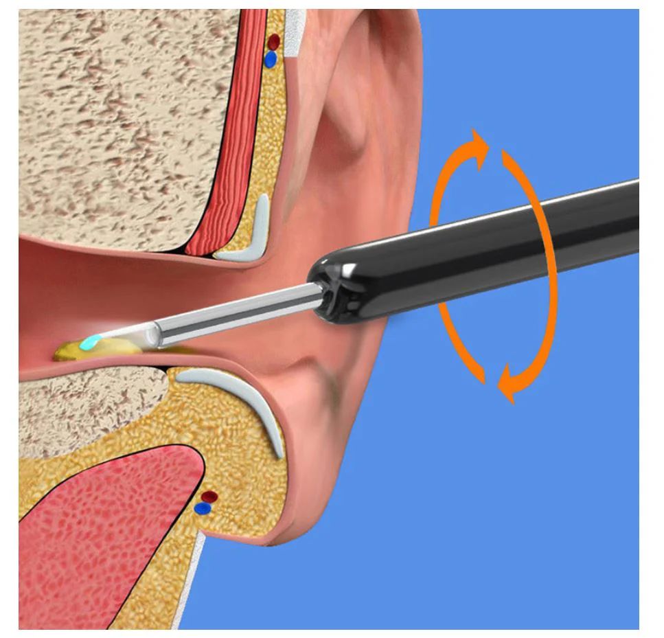Earwax Removal Kit Ear Cleaner Tool Set with Soft Spiral Cleaner for Adults & Kids UAE